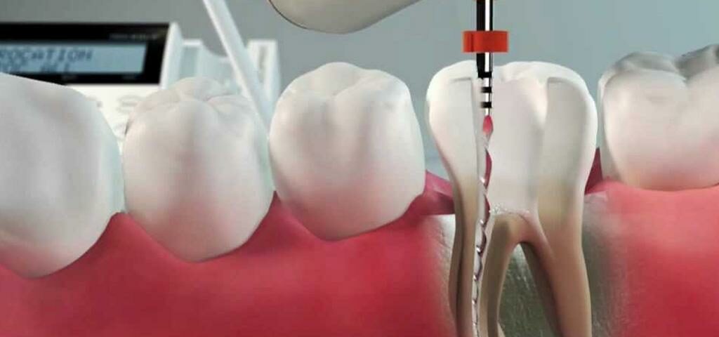 O que fazer quando o paciente não sabe onde está doendo? – Dental